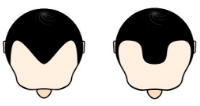 ヘアライン Mタイプ
