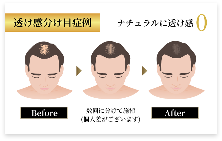 ビフォアアフター1