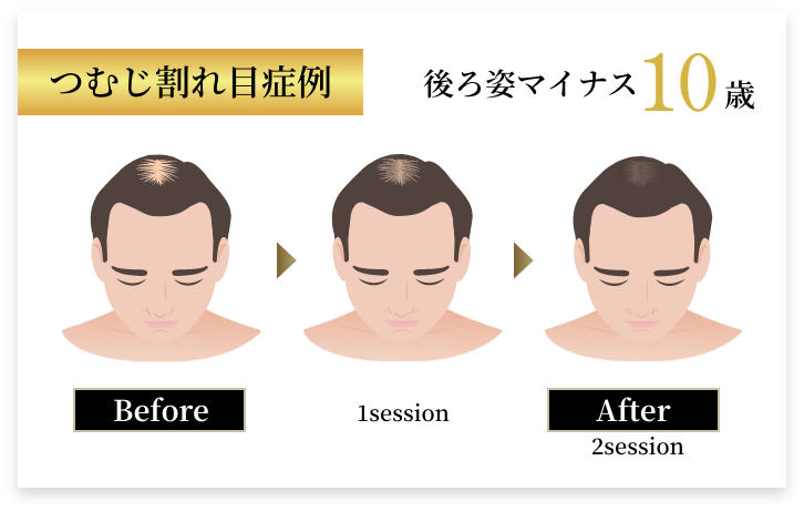 ビフォアアフター2