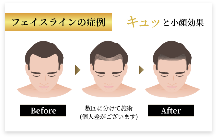 ビフォアアフター3