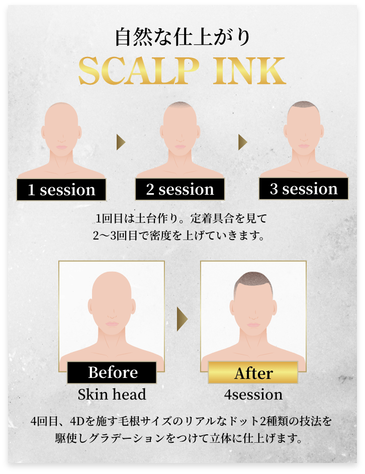 ビフォアアフター4